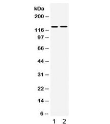 Western blot testing of human 1) SMMC and 2) 293 cell lysate with TRPM5 antibody. Expected/observed 