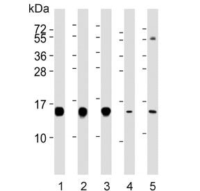 Western blot testing of human 1) Jurkat, 2) Raji, 3) HepG2, 4) rat brain and 5) mouse liver lysate w