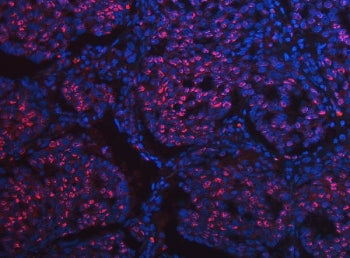 SCML1 Antibody
