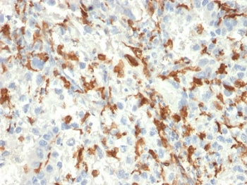 IHC testing of FFPE human kidney tissue with AIF1 antibody (clone AIF1/2493). HIER: boil tissue sect