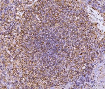 CD135 Antibody / FLT3