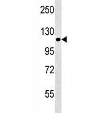 NALP12 antibody western blot analysis in mouse brain tissue lysate. Predicted molecular weight: ~119