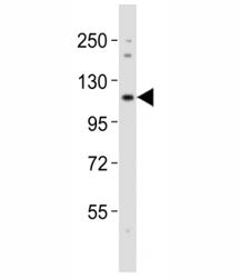 Notch1 Antibody