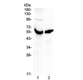 Western blot testing of human 1) placenta and 2) A431 lysate with VDBP antibody at 0.5ug/ml. Predict