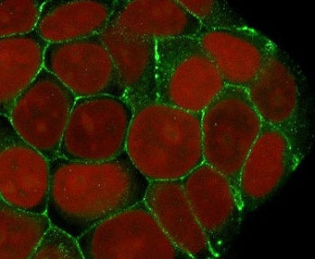 Immunofluorescent staining of human MCF7 cells with recombinant E-Cadherin antibody (clone ECD1-3R, 