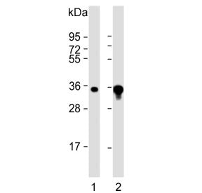 Western blot testing of human 1) A431 and 2) A549 cell lysate with AKR1B1 antibody. Predicted molecu