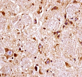 FGFR3 antibody immunohistochemistry analysis in formalin fixed and paraffin embedded mouse brain tis