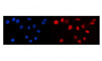 Immunofluorescent staining of FFPE human Caco-2 cells with TCF1 alpha antibody (red) and DAPI nuclea