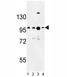BCL11A Antibody
