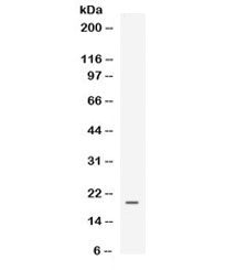 EG-VEGF Antibody / Prokineticin 1
