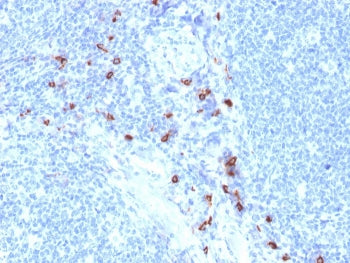 IHC staining of FFPE human tonsil with Mast Cell Tryptase antibody (clone TPSAB1/1963). HIER: boil t