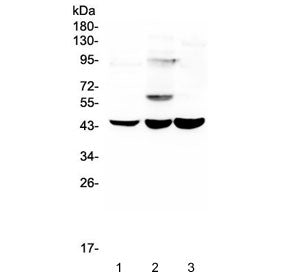 Western blot testing of human 1) T-47D, 2) A549 and 3) Caco-2 lysate with ELAVL2 antibody at 0.5ug/m