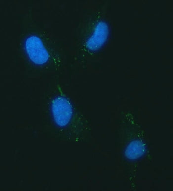 YKL-40 Antibody / CHI3L1