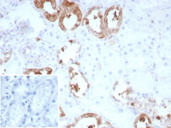 CKB Antibody / Creatine kinase B