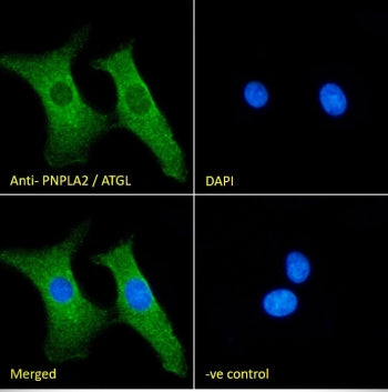 IF/ICC staining of fixed and permeabilized human HEK293 cells with Adipose triglyceride lipase antib