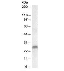 Western blot testing of human prostate lysate with SRD5A2 antibody at 0.3ug/ml. Predicted molecular 