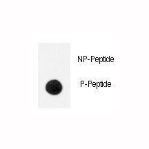 Dot blot analysis of phospho-TrkA antibody. 50ng of phos-peptide or nonphos-peptide per dot were spo