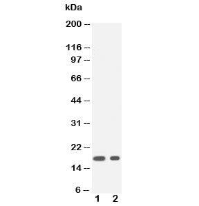 Western blot testing of IL1 beta antibody and Lane 1: recombinant human partial protein 20ng; 2: 10n