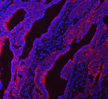 NDUFS5 Antibody