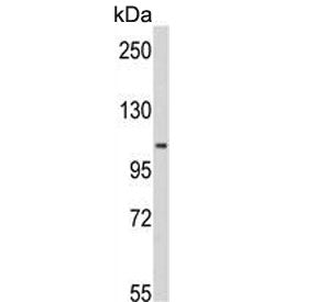 Western blot testing of human Y79 cell lysate with MTHFD1 antibody. Predicted molecular weight ~102 