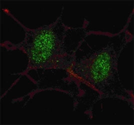 Fluorescent confocal image of SY5Y cells stained with SMAD2 antibody at 1:100. Note the highly speci