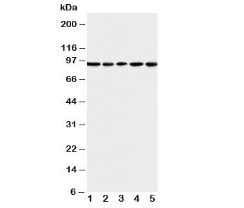 Western blot testing of MCM6 antibody and Lane 1: U87; 2: COLO320; 3: HeLa; 4: MCF-7; 5: Jurkat cell