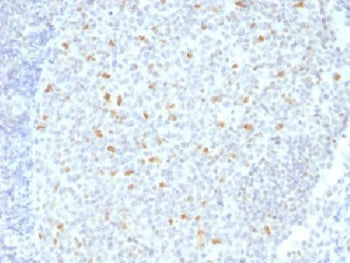 IHC testing of FFPE human tonsil tissue with Bcl6 antibody (clone BCL6/1526). Required HIER: boil ti