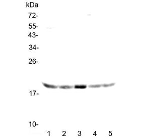 Western blot testing of human 1) HeLa, 2) placenta, 3) SW620, 4) A549 and 5) mouse NIH 3T3 lysate wi