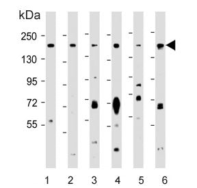 Western blot testing of human T-47D, 2) mouse testis, 3) human HeLa, 4) human MCF7, 5) mouse NIH 3T3