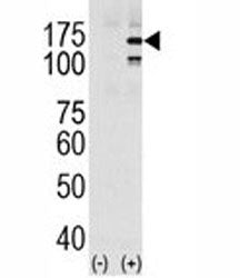 p-EGFR Antibody (pY1069)
