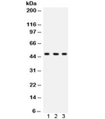 Western blot testing of human 1) COLO320, 2) 293, and 3) HeLa lysate with CTBP2 antibody. Predicted/