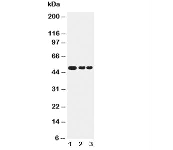 Western blot testing of GFAP antibody and Lane 1: human U87 cell lysate; 2: mouse brain; 3: rat brai