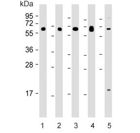 Western blot testing of human 1) lung, 2) kidney, 3) pancreas, 4) testis and 5) MDA-MB-453 lysate wi