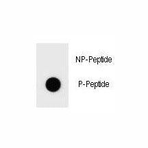 Dot blot analysis of phospho-Bad antibody. 50ng of phos-peptide or nonphos-peptide per dot were spot