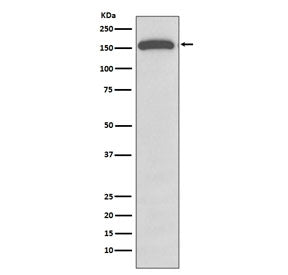 GLI1 Antibody / Glioma associated oncogene 1