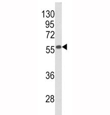Beclin-1 Antibody