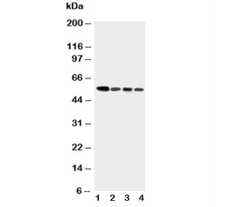 Western blot testing of Caspase-10 antibody and human tumor cell lysates 1: COLO320; 2: HeLa; 3: SW6