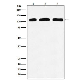 Western blot testing of 1) human K562, 2) mouse RAW264 and 3) rat kidney lysate with PIK3CD antibody