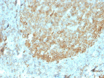 IHC staining of FFPE human tonsil tissue with recombinant MALT1 antibody (clone rMT1/410). Required 