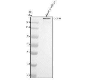Western blot analysis of Dicer protein using Zebrafish Dicer antibody and zebrafish embryo tissue ly