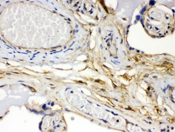 FGF1 Antibody
