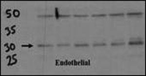 Endothelial cell lysate transferred to membrane was incubated with DSCR1 antibody at a 1:500 dilutio