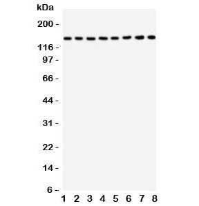 Western blot testing of TSC1 antbody and rat samples: 1. skeletal muscle; 2. heart; 3. brain; 4. lun
