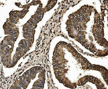 PSMB7 Antibody / Proteasome 20S beta 7