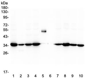 Western blot testing of human 1) HeLa, 2) placenta, 3) Caco-2, 4) HepG2, 5) Rabbit IgG, 6) marker, 7