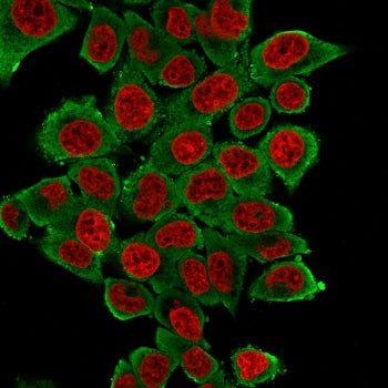 Immunofluorescent staining of fixed human HeLa cells with Smooth Muscle Actin antibody (clone SPM332