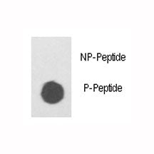 Dot blot analysis of phospho ILK antibody. 50ng of phos-peptide or nonphos-peptide per dot were spot