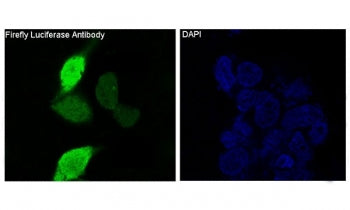 Immunofluorescent staining of human 293 cells transfected with Firefly Luciferase using Firefly Luci