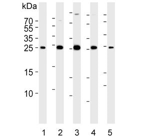 Western blot testing of human 1) HeLa, 2) HUVEC, 3) MCF7, 4) SH-SY5Y and 5) mouse lung lysate with C