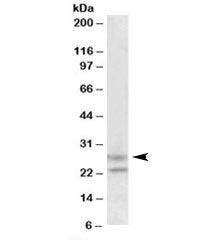Western blot testing of human cerebellum lysate with FBXO44 antibody at 1.5ug/ml. Predicted molecula